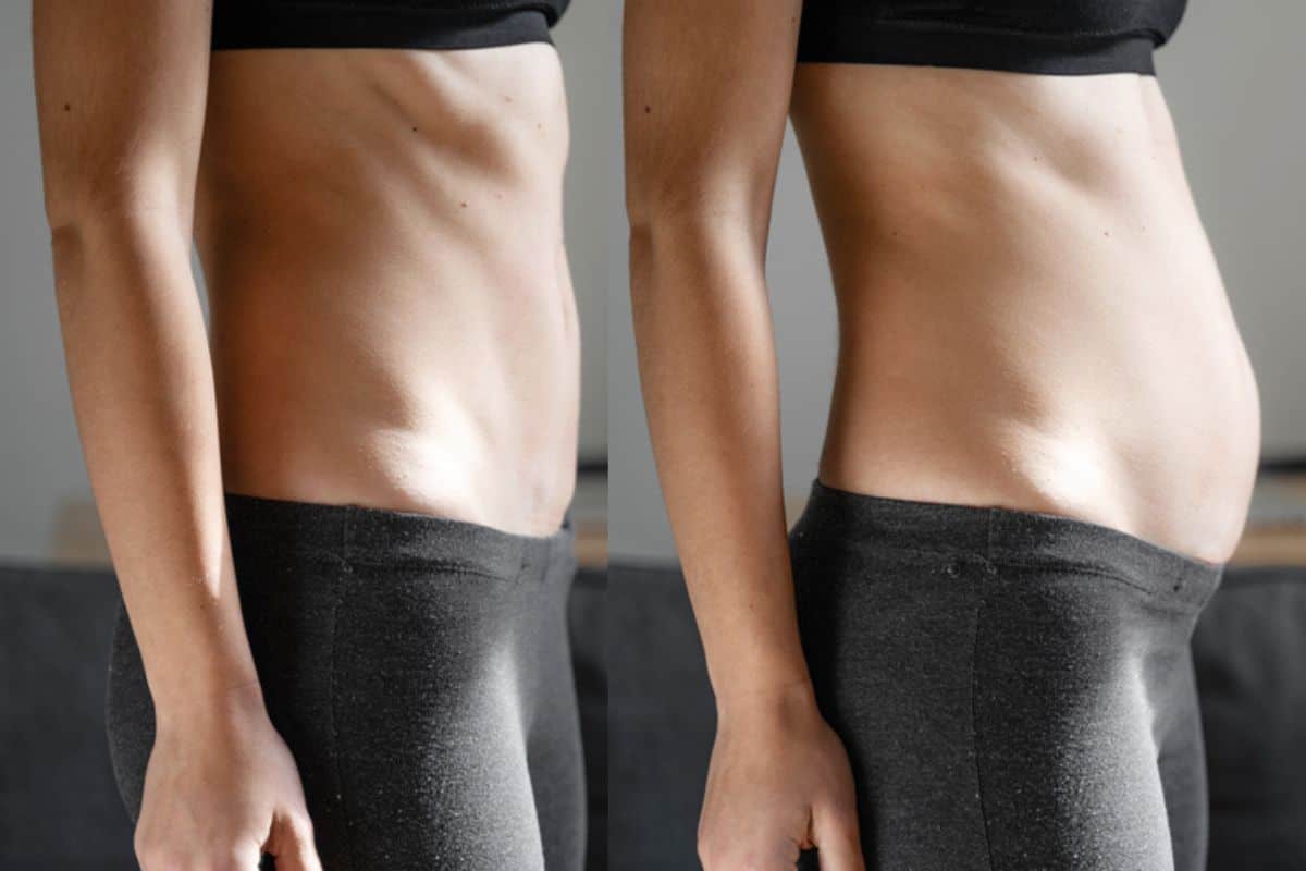 How long does diastasis recti take to improve Sutton?