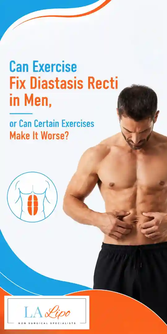 Can Exercise Fix Diastasis Recti in Men, or Can Certain Exercises Make It Worse Sutton?